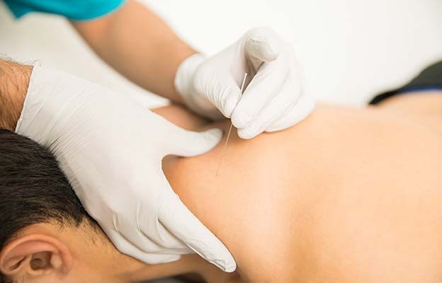 dry-needling-in-sydney dry-needling-in-sydney