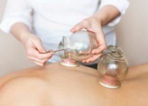 benefits does cupping therapy work sydney