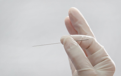Pros and Cons of Dry Needling: A Comprehensive Overview